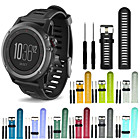 Acessórios para Smartwatch