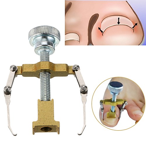 

Bend Volume Toenails Braces Support Manicure Toe Paronychia Nail Brace Tools Ingrown Toenails Pedicure Tool