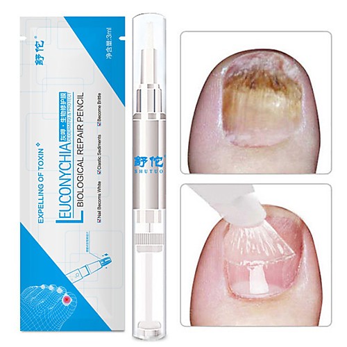 

1PC 3ML Fungal Nail Treatment Pen Onychomycosis Paronychia Anti Fungal Nail Infection Chinese Herbal Care Medicinal Liquid